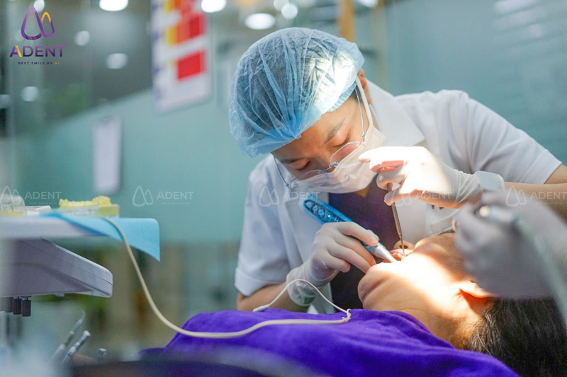 Quy trình lấy cao răng