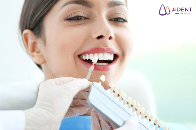 Răng sứ kim loại và răng toàn sứ răng nào tốt hơn