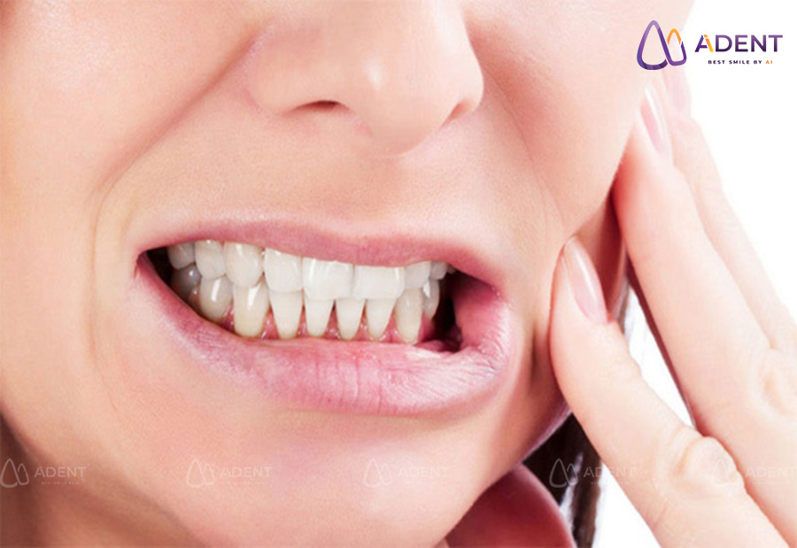 Nghiến răng khi ngủ hoặc khi căng thẳng