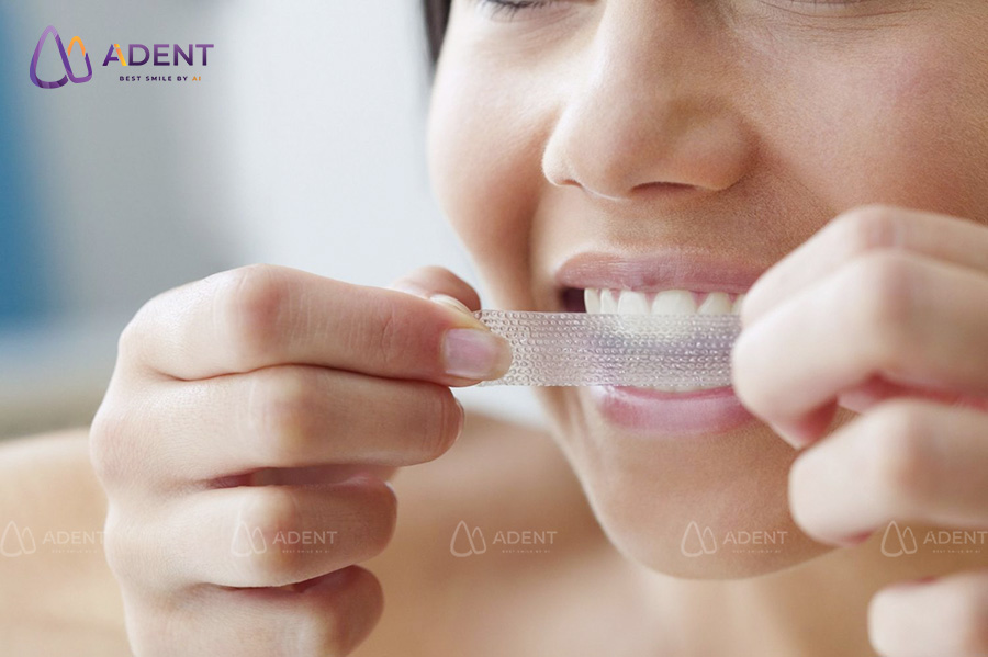 Lạm dụng sản phẩm làm trắng răng không kiểm soát