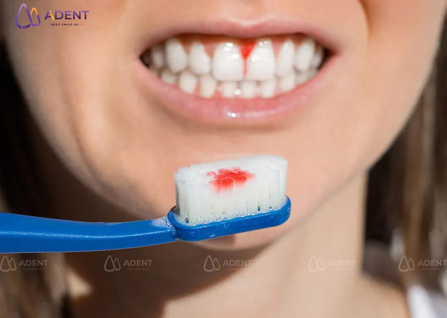 7 dấu hiệu cảnh báo răng miệng mà 90% người Việt bỏ qua