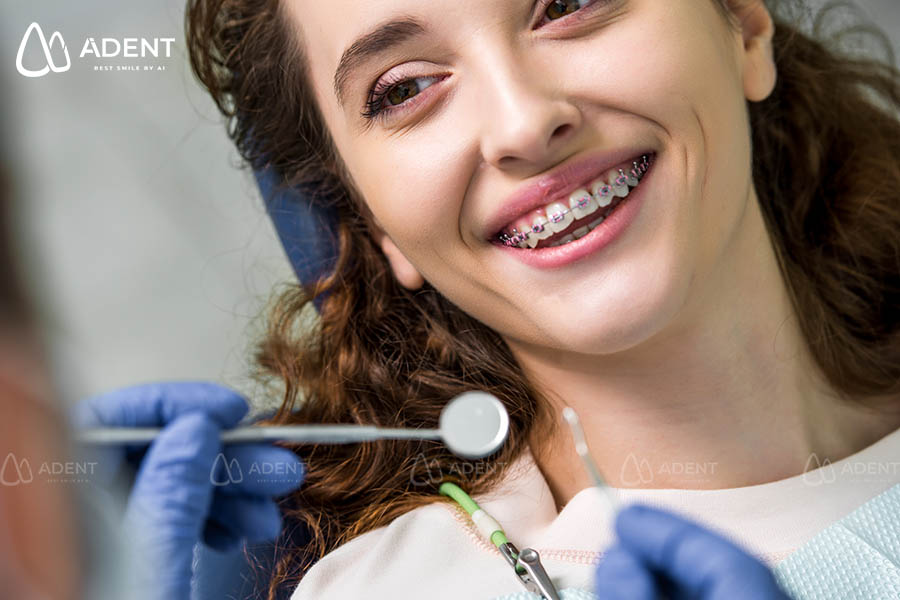 Minivis có tác dụng như thế nào trong niềng răng?